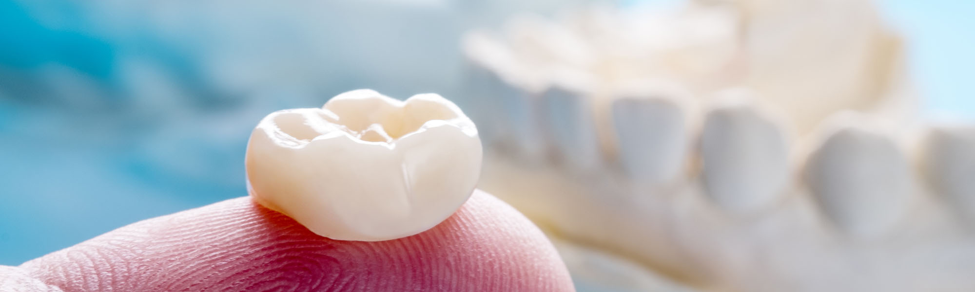 Dental Crowns Montclair CA