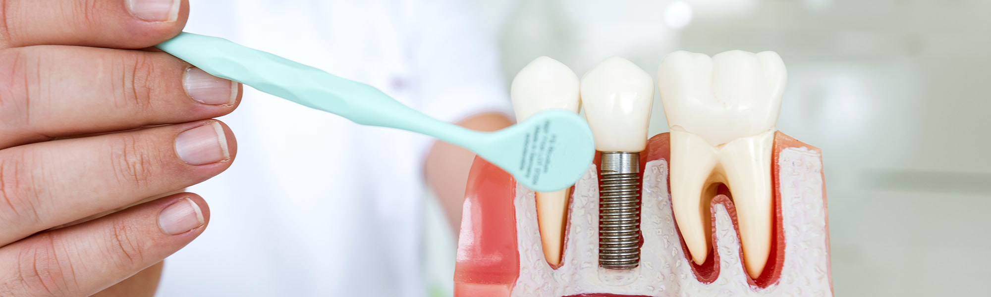 Dental FAQ Questions
