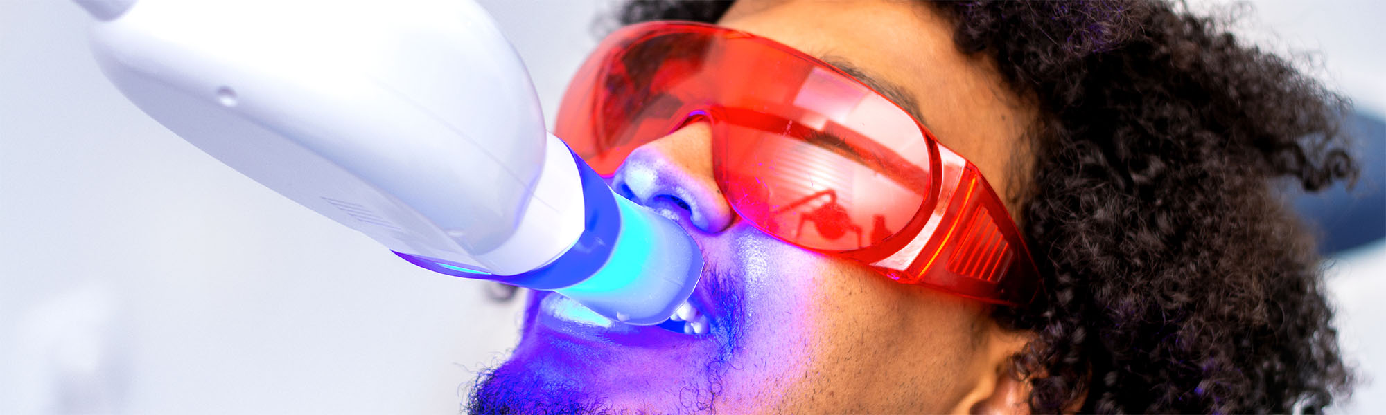How Long Does Teeth Whitening Last at Dentist of Montclair in Montclair CA
