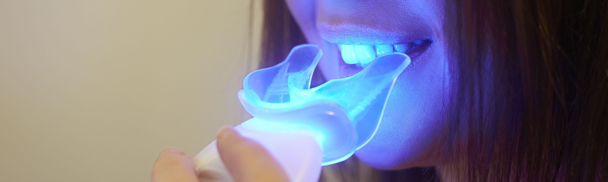 What Is Teeth Whitening in Montclair CA